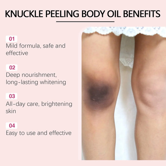 Ouhoe 125ml Body Whitening Essence Oil Deep Moisturizing Armpits Knees Knuckle Joint Peeling Lighten Dark Skin Body Care Essence