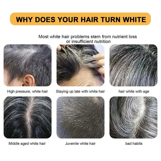 Hair Darkening Shampoo Bar White Hair To Black Shampoo Soap Black Hair Shampoo Cover Grey Hair Soap Conditioner Repair Essence