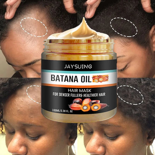 Fast Hair Growth Oil Africa Crazy Traction Treatment Hair Loss spray Hair Regrowth Powerful Hair Root Repair Hair Mask Hair Care