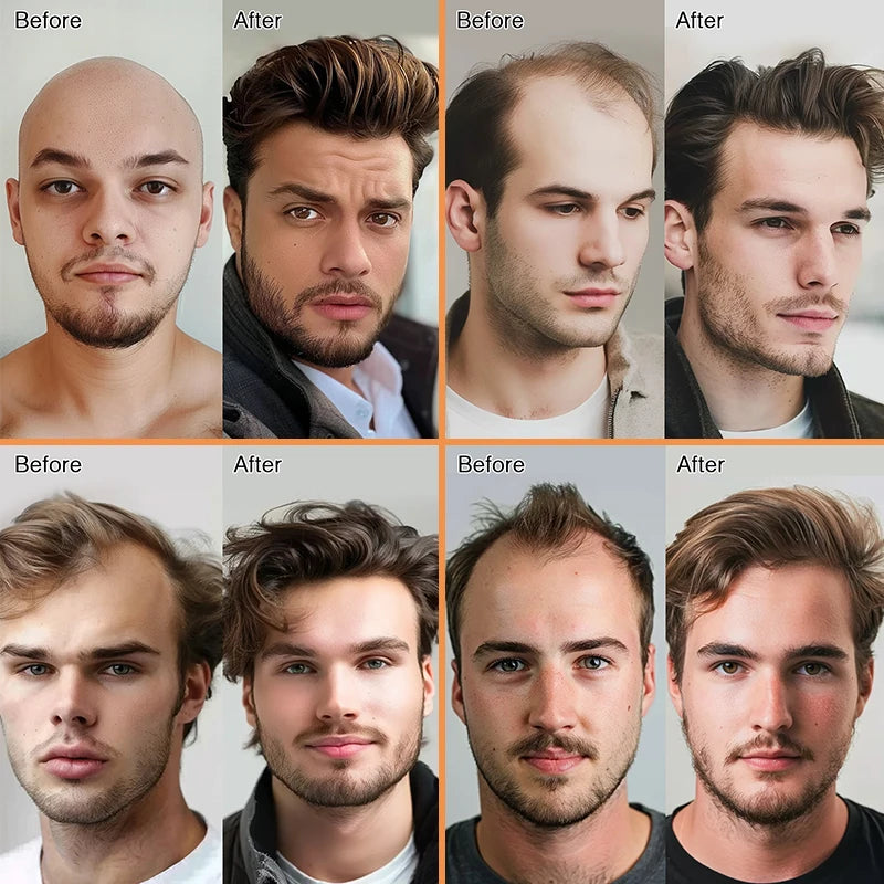 EMEDA V-looped Mens Hair Pieces 0.02mm 0.04mm Ultra Super Thin Skin Hair Replacement