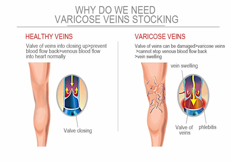 Compression Socks Varicose Veins Men's And Women's Sports Socks Football 20-30 Mmhg Elastic Anti Fatigue Pain Relief Wholesale
