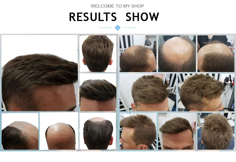 0.08mm Thickness PU Poly Base Double Knotted Toupee Human Hair Durable Time Long Lifespan Men's Capillary Prothesis