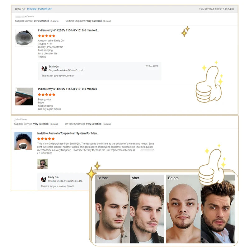 EMEDA V-looped Mens Hair Pieces 0.02mm 0.04mm Ultra Super Thin Skin Hair Replacement