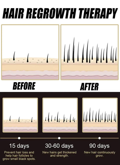 Hair Strengthening Root Care Scalp Massage Essence Minimize Fallout Grow Fuller Hair 2026