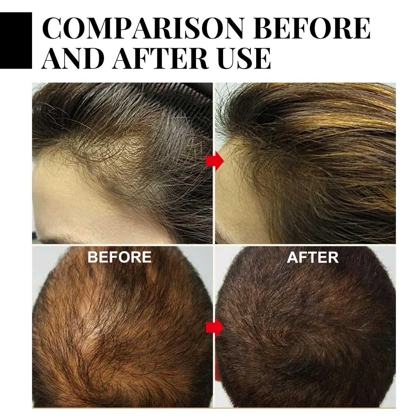Fast Hair Growth Oil Africa Crazy Traction Treatment Hair Loss spray Hair Regrowth Powerful Hair Root Repair Hair Mask Hair Care
