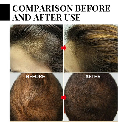 Fast Hair Growth Oil Africa Crazy Traction Treatment Hair Loss spray Hair Regrowth Powerful Hair Root Repair Hair Mask Hair Care