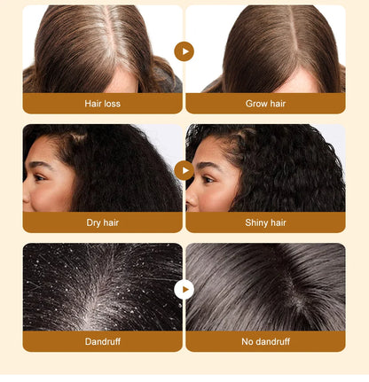 Lewedo Naturals Batana Oil Fast Hair Growth for Men Women Pure Batana Oil Nourish Shiny Hair Healthy Hair Care Anti Hair Loss