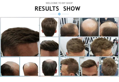 Pwigs 12 Inch Full French Lace Men Toupee 1b80 20% Human Black Hair Mixed with 80% Synthetic Gray European Hair System
