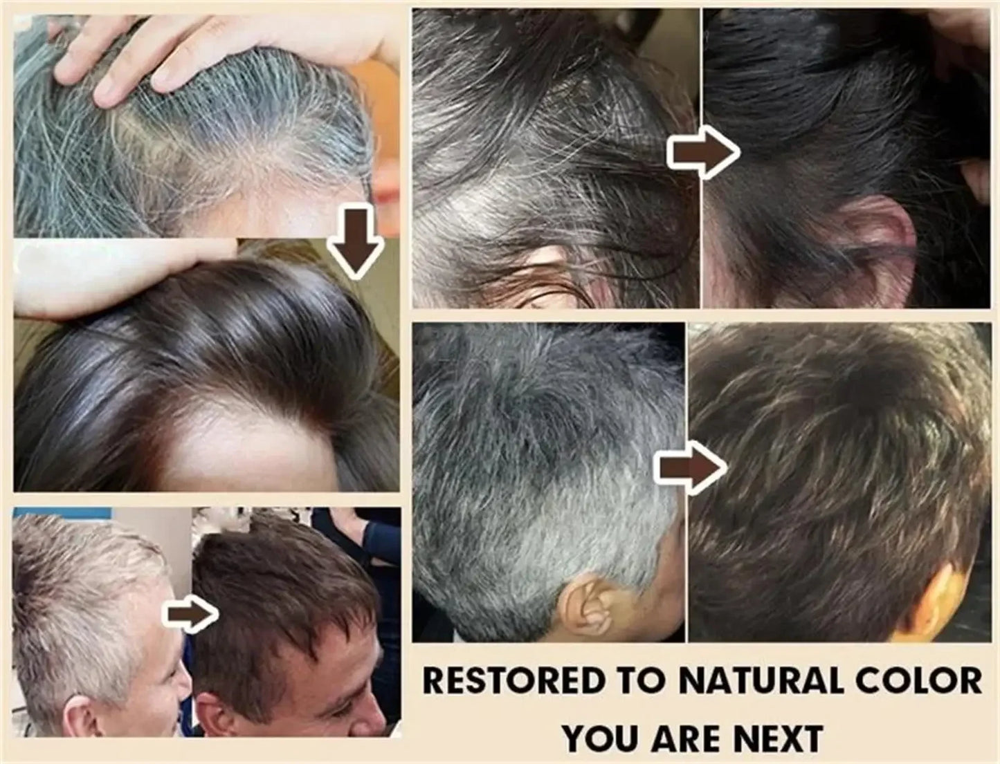 Gray White Hair Treatment Serum White To Black Repair Natural Color Black Rice Nourish Spray Anti Loss Hair High Quality Product