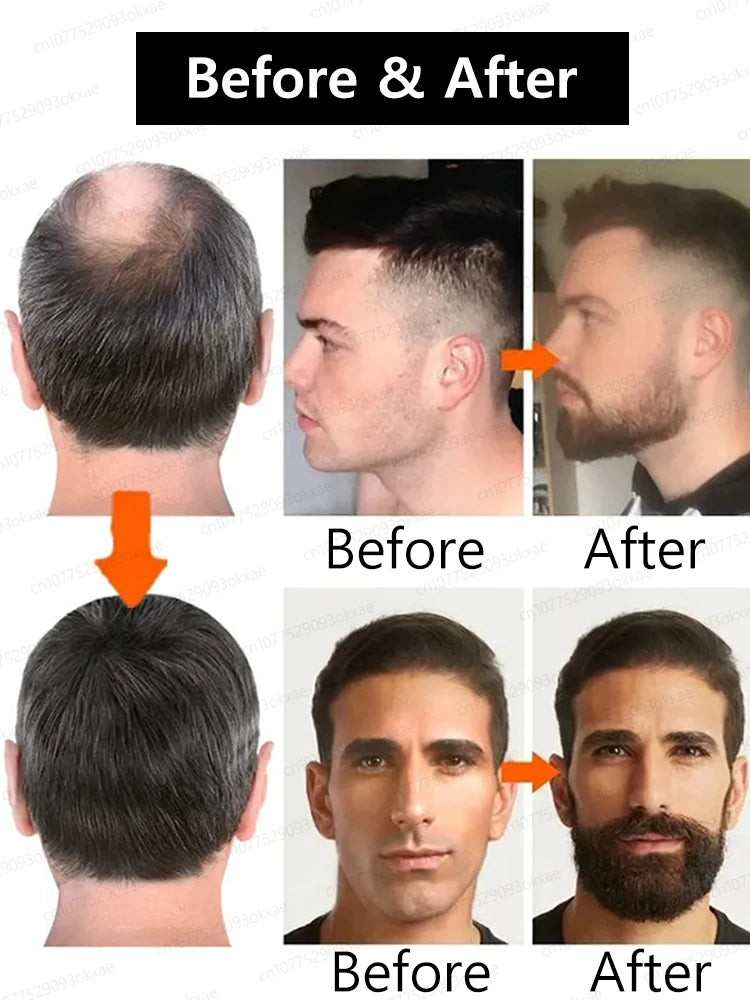 The secret to becoming a stylish man! A thick beard makes it easy to pull off any look and look handsome.