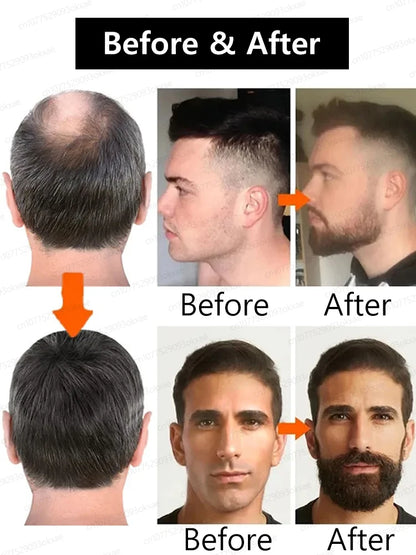 The secret to becoming a stylish man! A thick beard makes it easy to pull off any look and look handsome.