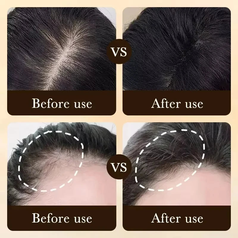 Hair Growth Essential Oil | Anti Hair Loss Regrowth Treatment,Nourishes Scalp & Strengthens Hair, Lightweight Non-Greasy Formula