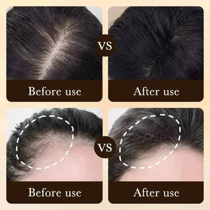 Hair Growth Essential Oil | Anti Hair Loss Regrowth Treatment,Nourishes Scalp & Strengthens Hair, Lightweight Non-Greasy Formula