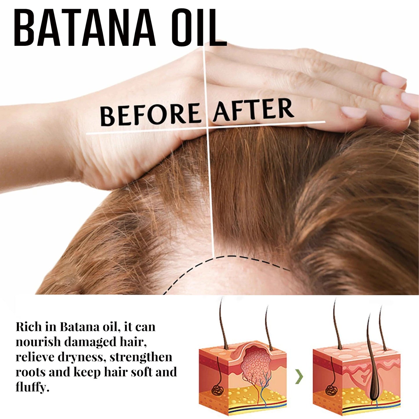 Fast Hair Growth Oil Africa Crazy Traction Treatment Hair Loss spray Hair Regrowth Powerful Hair Root Repair Hair Mask Hair Care
