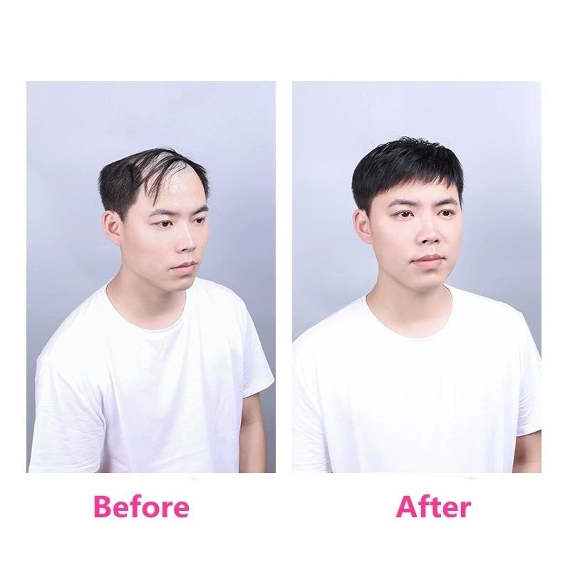 100% Human Hair Toupee Wigs for Men Hair Male Wig Capillary Prothesis Replacement System Men's Wig Real Hair for Cover Grey Hair