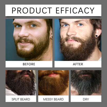 East Moon Beard Growth Serum Set Promotes Whisker Growth Strengthen Hair Roots Soften Skin Moisturizing Hydration Beard Care