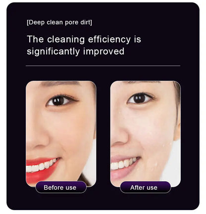 Face Beauty Device Facial Massager Cleansing Import Export Machine Skin Tightening Lifting Anti Aging Wrinkle Removal for Face E