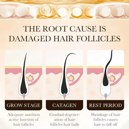 Hair Growth Essential Oil | Anti Hair Loss Regrowth Treatment,Nourishes Scalp & Strengthens Hair, Lightweight Non-Greasy Formula