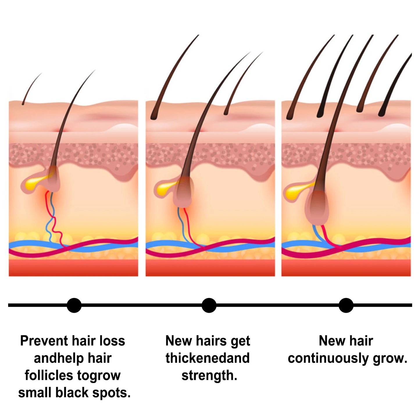 Fast Hair Growth Oil Africa Crazy Traction Treatment Hair Loss spray Hair Regrowth Powerful Hair Root Repair Hair Mask Hair Care