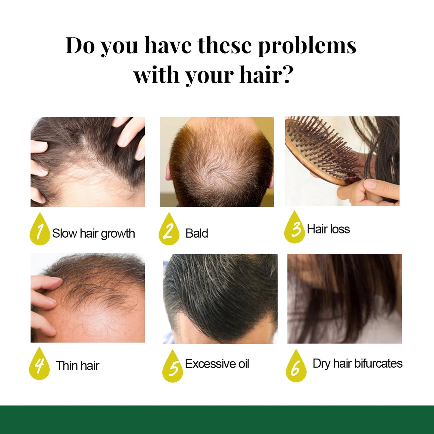 Ginger Oil Hair Booster Serum Spray Nourish Scalp Hair Follicles Refresh Control Oil Strengthen Hair Roots Nutrient Solution