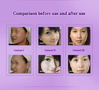 ARTISCARE Essential Oils Beauty Eyes Stretch Marks Removal Body Slimming Breast Enlargement Aromatherapy Massage Oil