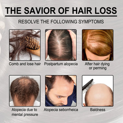 Fast Hair Growth Oil Africa Crazy Traction Treatment Hair Loss spray Hair Regrowth Powerful Hair Root Repair Hair Mask Hair Care
