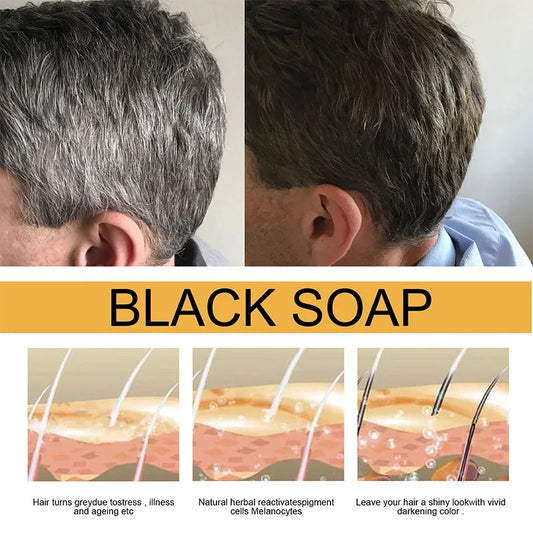 Polygonum Multiflorum Black Hair Soap Darkening Shampoo Bar Repair Gray White Color Hair Dye Shampoo For Men Women Hair Care