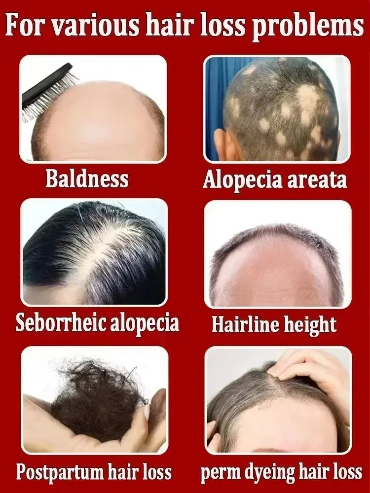 Essential Loss Regrowth Treatment Strengthens Hair Nourishes Scalp Light Weight Non Greasy Improve Scalp Circulation
