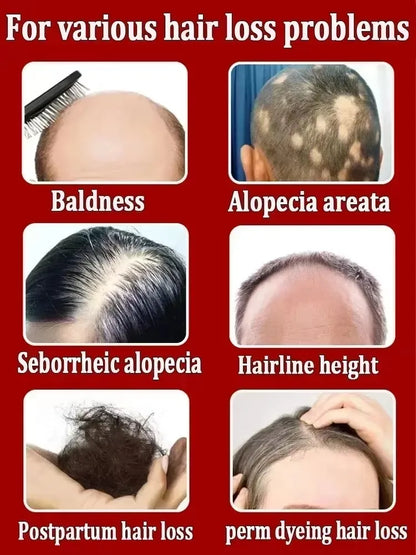 Essential Loss Regrowth Treatment Strengthens Hair Nourishes Scalp Light Weight Non Greasy Improve Scalp Circulation
