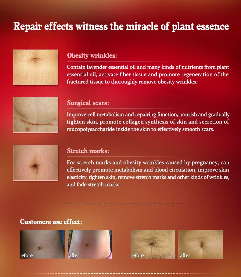 ARTISCARE Essential Oils Beauty Eyes Stretch Marks Removal Body Slimming Breast Enlargement Aromatherapy Massage Oil