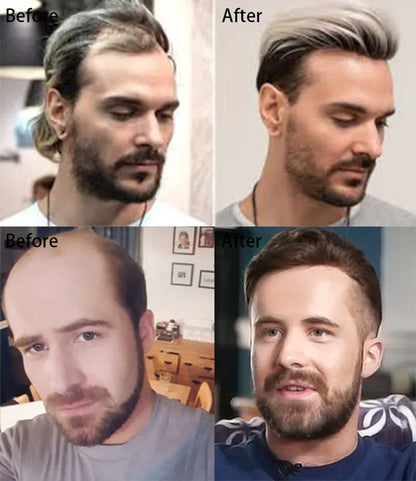 Gloryhair-Natural and Realistic Hair Prosthesis Male Toupee Wig 130% Density Hair Pieces Indian Human Men's Capillary Prosthesis