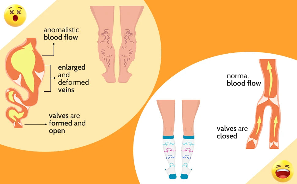 2XL-7XL Plus Size 20-30 mmHg Compression Socks for Women Men Wide Calf Extra Large Knee High Flight Sock for Circulation Support