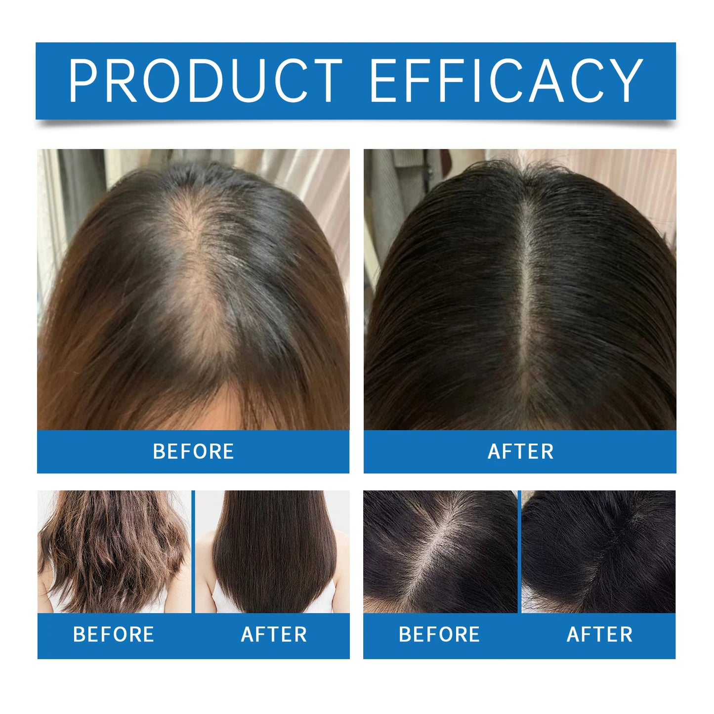 Rosemary Scalp Massager Roll-On Serum Repairing Damaged Dry Scalp Hydrate Anti Hair Loss Strengthen Hair Roots Smooth Hair Care