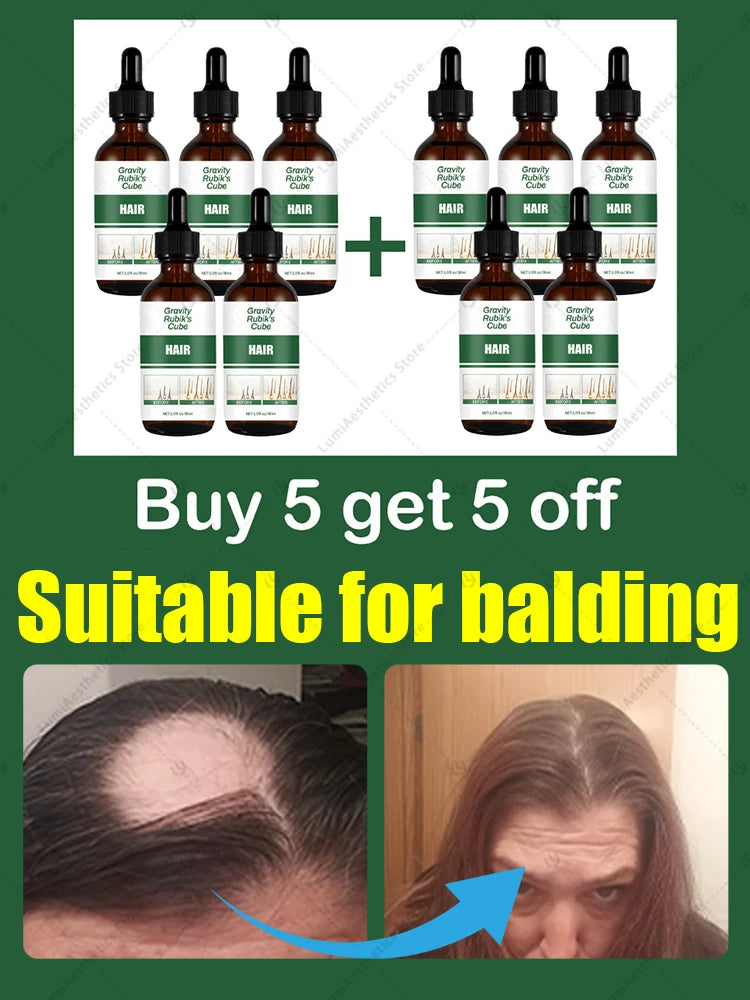 30 days to get a frizzy sea of hair, forehead, hairline and parting are all done