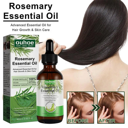 Rosemary Essential Oil with Dropper, 1/3PCS Rosemary Oil for Hair Growth, Hair Strengthening, Nourishing & Volumizing Refreshing
