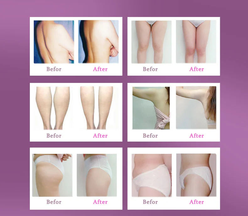 ARTISCARE Essential Oils Beauty Eyes Stretch Marks Removal Body Slimming Breast Enlargement Aromatherapy Massage Oil