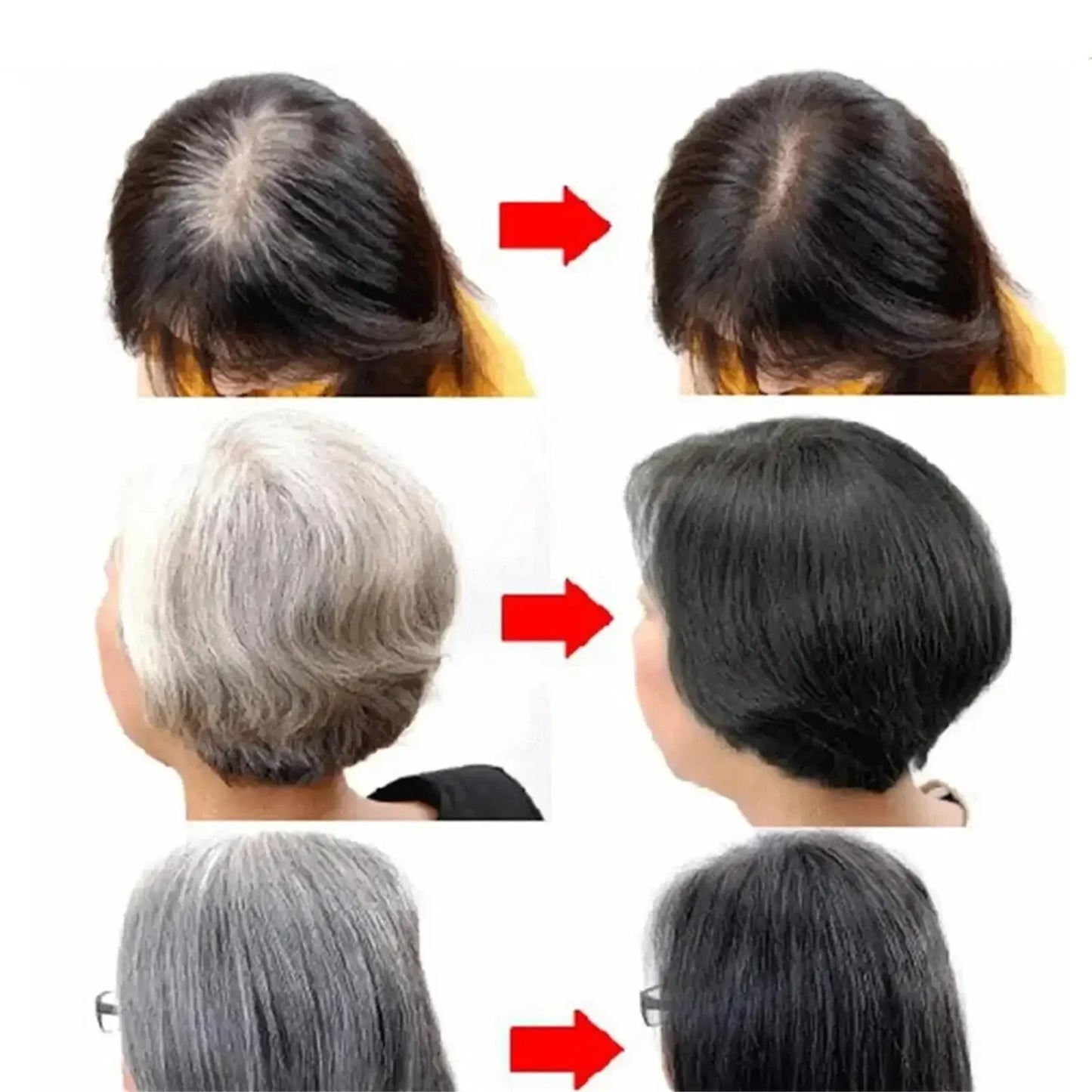 Gray White Hair Treatment Serum White To Black Repair Natural Color Black Rice Nourish Spray Anti Loss Hair High Quality Product