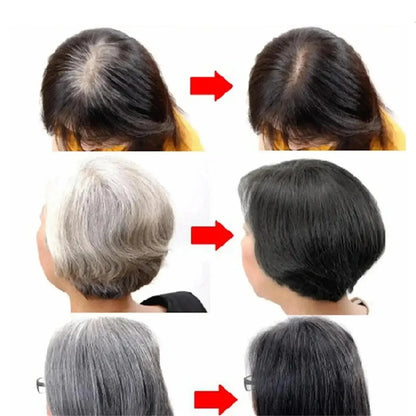 Gray White Hair Treatment Serum White To Black Repair Natural Color Black Rice Nourish Spray Anti Loss Hair High Quality Product