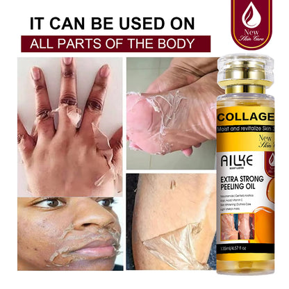 AILKE Collagen Yellow Peeling Oil For All Skin Types, Stretch Mark Removal, Lightening , Improve Rough Skin, Gentle Exfoliation