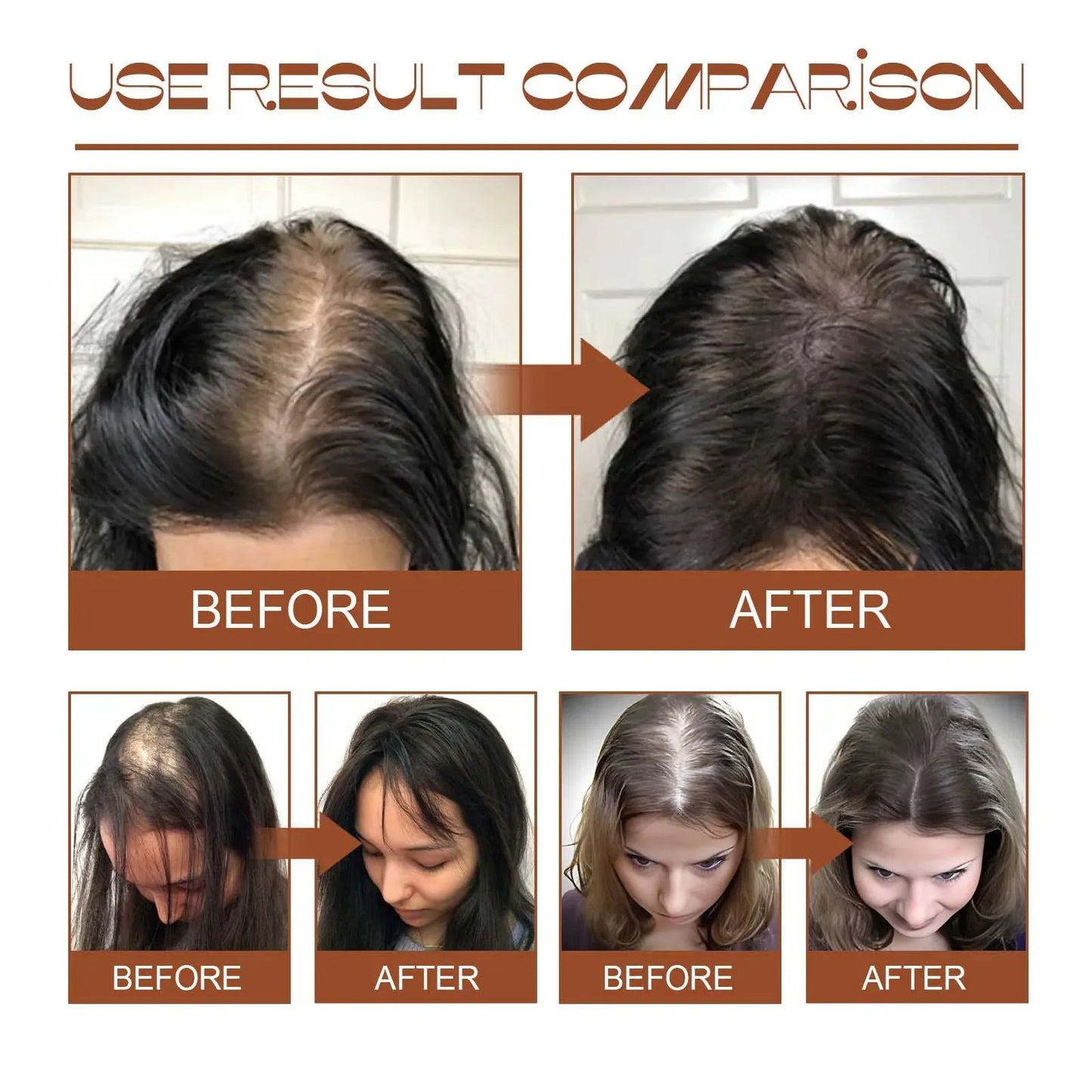 Batana Oil Nourishing Hair Oil Smoothing Shine Soft Hair Serum Repair Damaged Frizz Dry Hair Treatment Hair Care