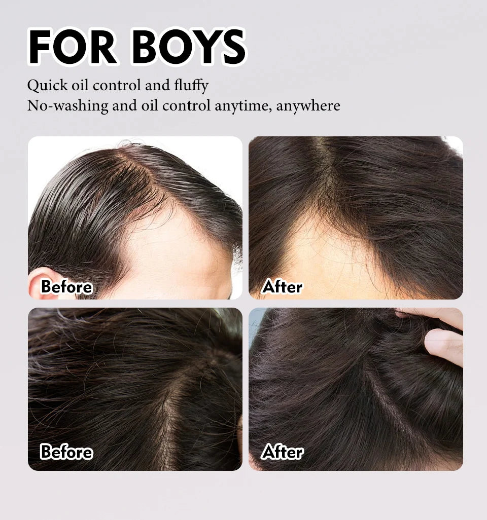 Sevich Hair Styling Powder 20g Fluffy Thin Hair Powder Spray Increases Hair Volume Captures Haircut Unisex Styling Hairspray