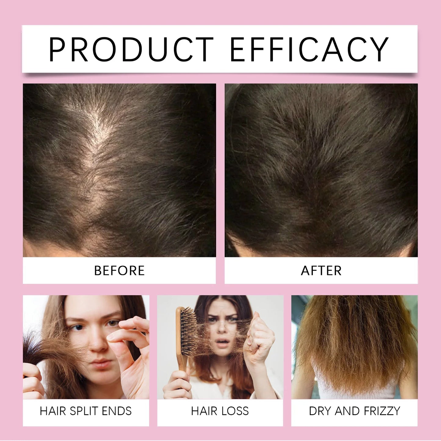 Rosemary Care Hair Essential Oil for Hair Growth Strengthens & Prevents Hair Loss Repairs Dryness & Split Ends Scalp Treatment
