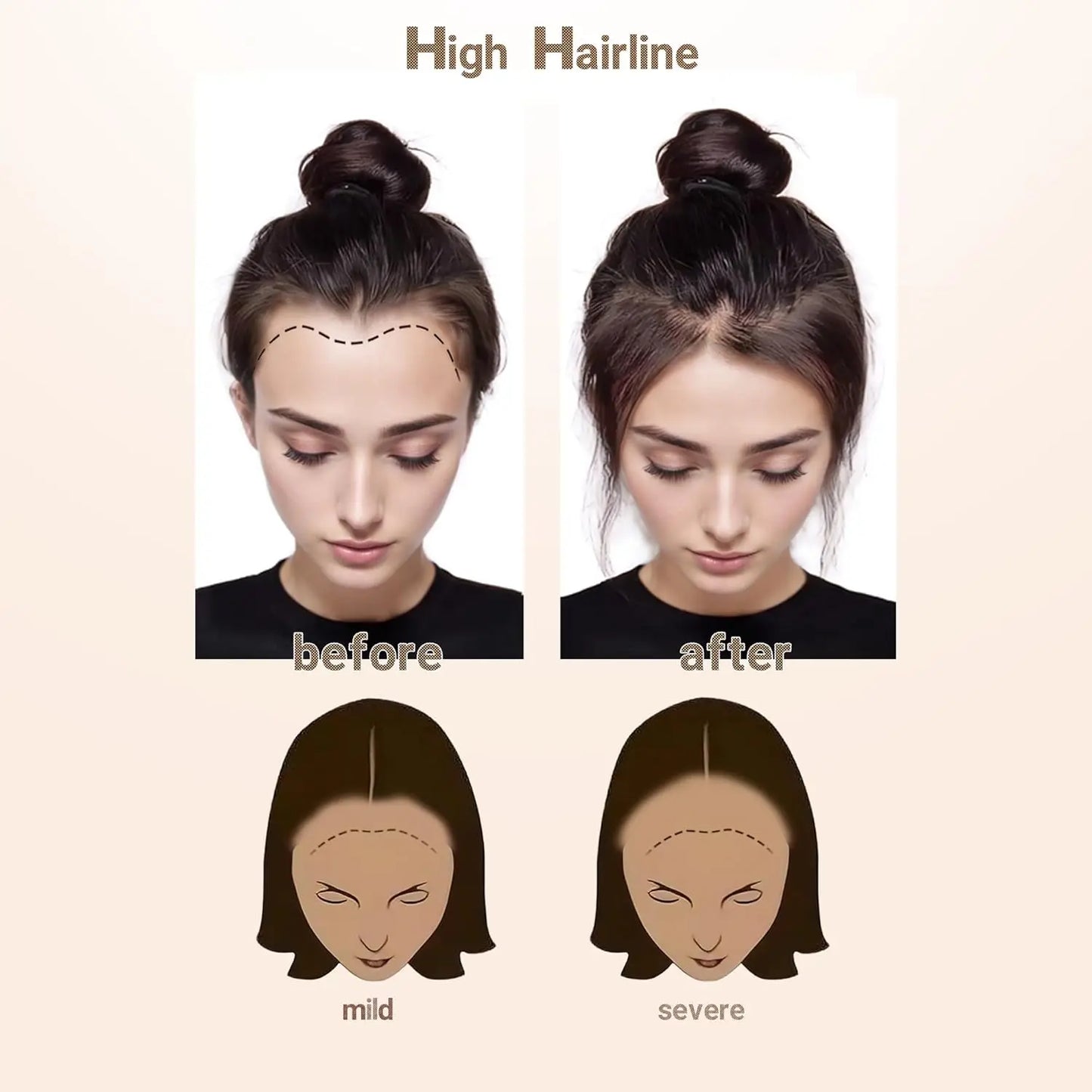 613 Blonde Human Hair Topper – PU Thin Skin Tape-In Toupee for Men & Women – V-Shape Hairline 13inch Straight Natural Hairpiece