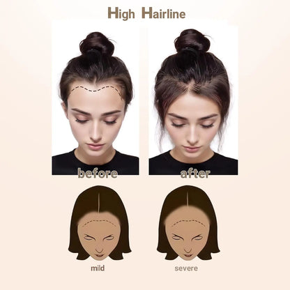 613 Blonde Human Hair Topper – PU Thin Skin Tape-In Toupee for Men & Women – V-Shape Hairline 13inch Straight Natural Hairpiece
