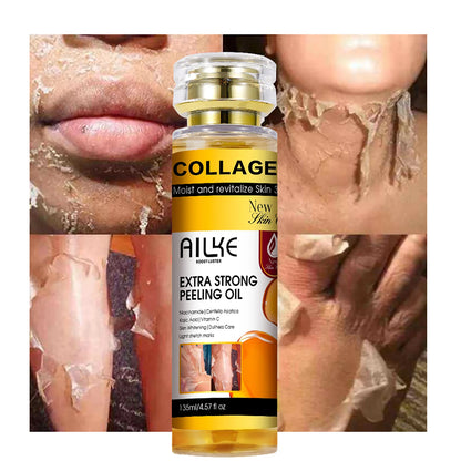 AILKE Collagen Yellow Peeling Oil For All Skin Types, Stretch Mark Removal, Lightening , Improve Rough Skin, Gentle Exfoliation