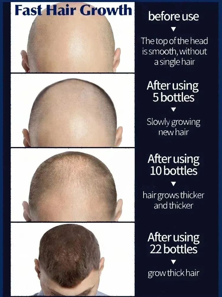 Essential Loss Regrowth Treatment Strengthens Hair Nourishes Scalp Light Weight Non Greasy Improve Scalp Circulation