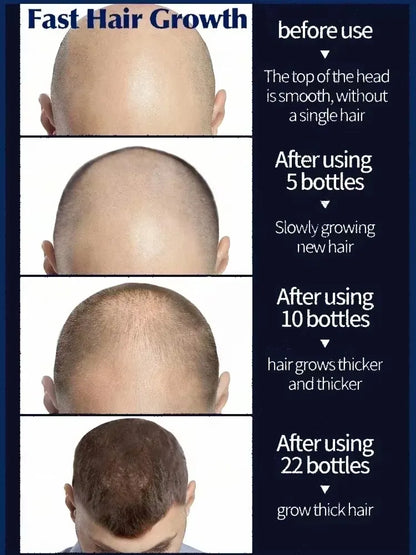 Essential Loss Regrowth Treatment Strengthens Hair Nourishes Scalp Light Weight Non Greasy Improve Scalp Circulation