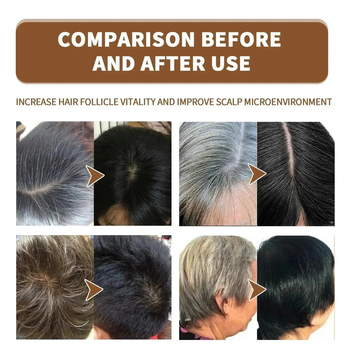 Gray White Hair Treatment Serum White To Black Repair Natural Color Black Rice Nourish Spray Anti Loss Hair High Quality Product