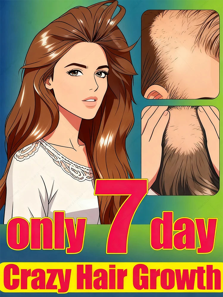 30 days to get a frizzy sea of hair, forehead, hairline and parting are all done